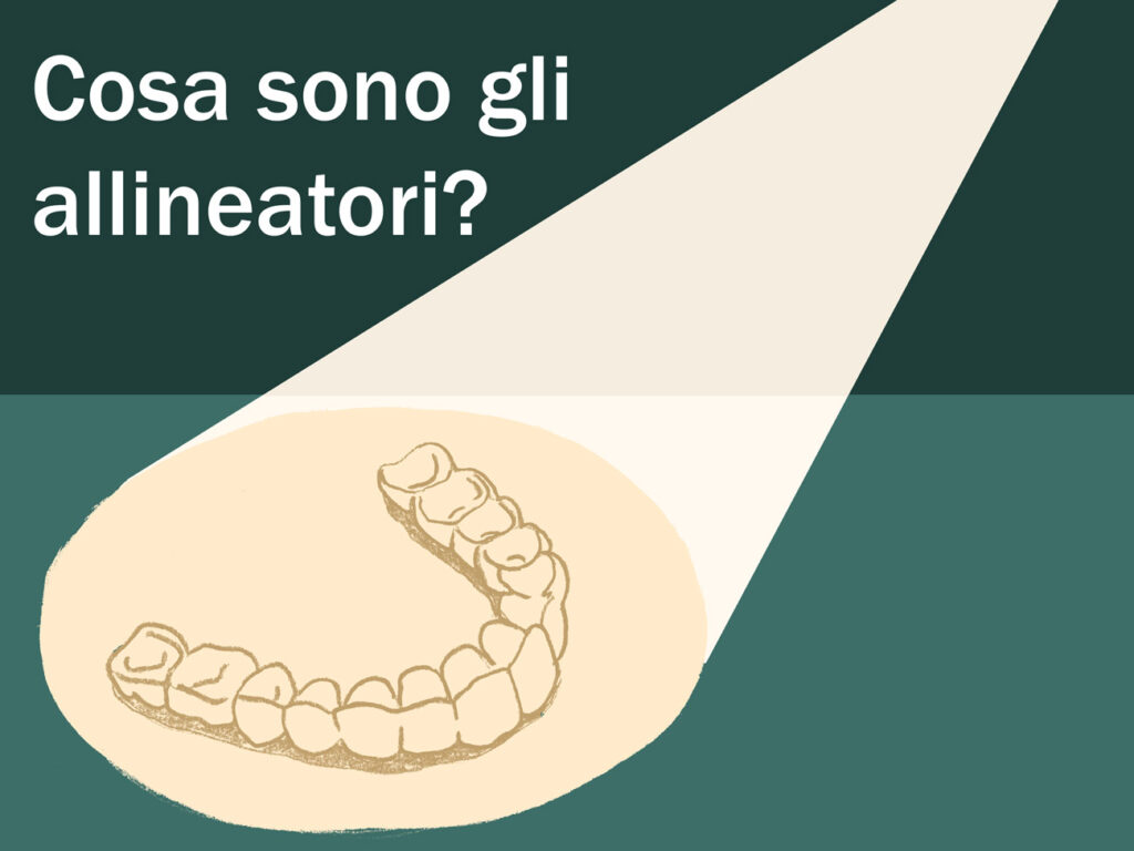 Cosa sono gli allineatori