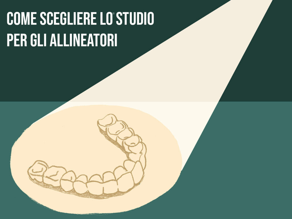 Come scegliere lo studio per i tuoi allineatori, mascherine dentali